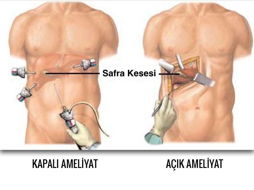 Gluten Free Diet  Op. Dr. Mehtap ERTÜRK